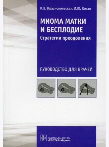 Миома матки и бесплодие: стратегии преодоления: руководство для врачей