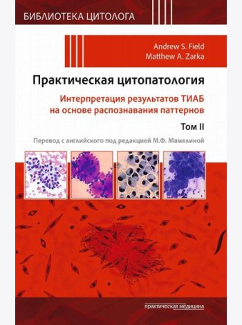 Практическая цитопатология. Интерпретация результатов ТИАБ на основе распознавания паттернов. В 2 т. Т. 2