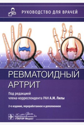 Ревматоидный артрит: руководство для врачей. 2-е изд., перераб. и доп
