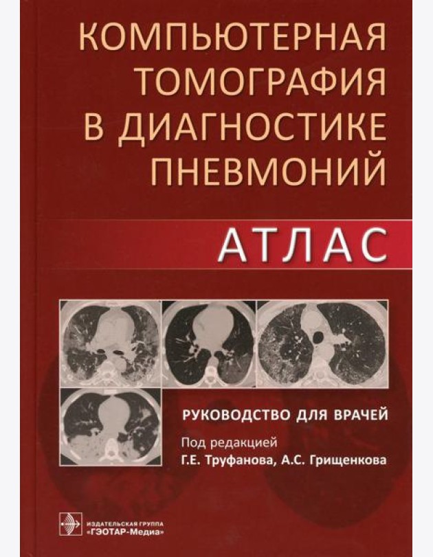 Компьютерная томография в диагностике пневмоний. Атлас: руководство для врачей