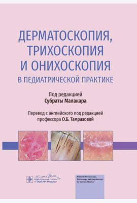 Дерматоскопия, трихоскопия и онихоскопия в педиатрической практике