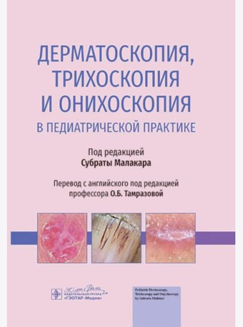 Дерматоскопия, трихоскопия и онихоскопия в педиатрической практике