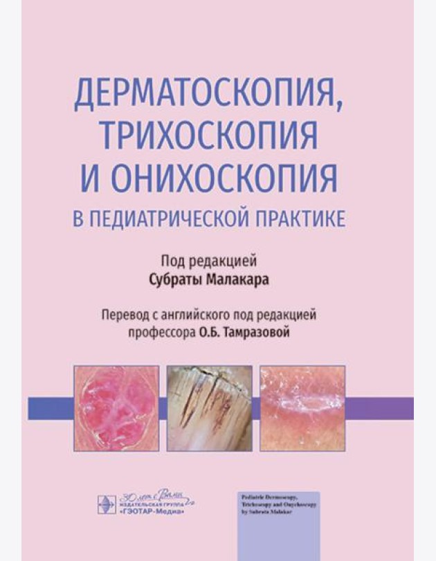 Дерматоскопия, трихоскопия и онихоскопия в педиатрической практике