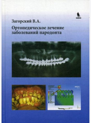 Ортопедическое лечение заболеваний пародонта