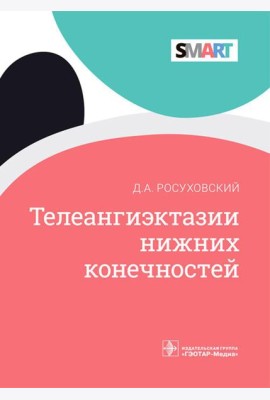 Телеангиэктазии нижних конечностей