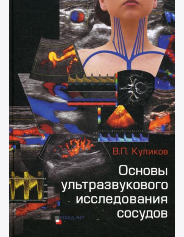 Основы ультразвукового исследования сосудов