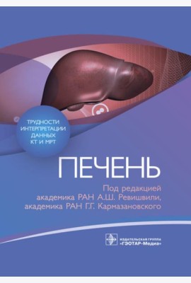 Трудности интерпретации данных КТ и МРТ: печень