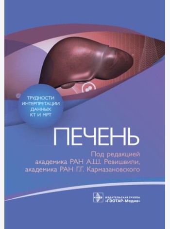 Трудности интерпретации данных КТ и МРТ: печень
