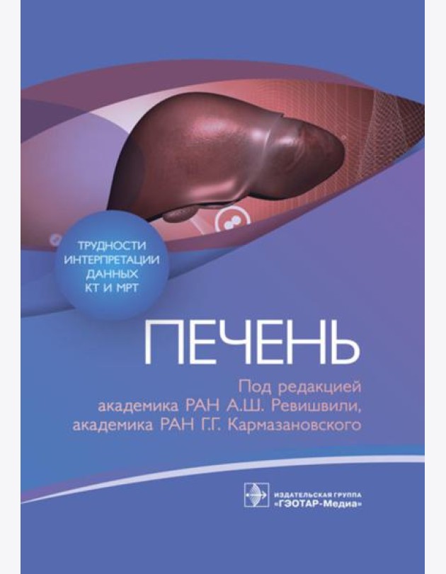 Трудности интерпретации данных КТ и МРТ: печень