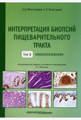 Интерпретация биопсий пищеварительного тракта. Т. 2: Новообразования