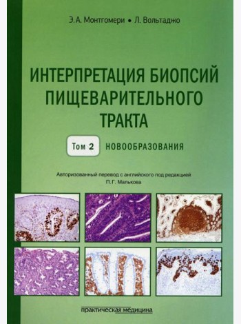 Интерпретация биопсий пищеварительного тракта. Т. 2: Новообразования
