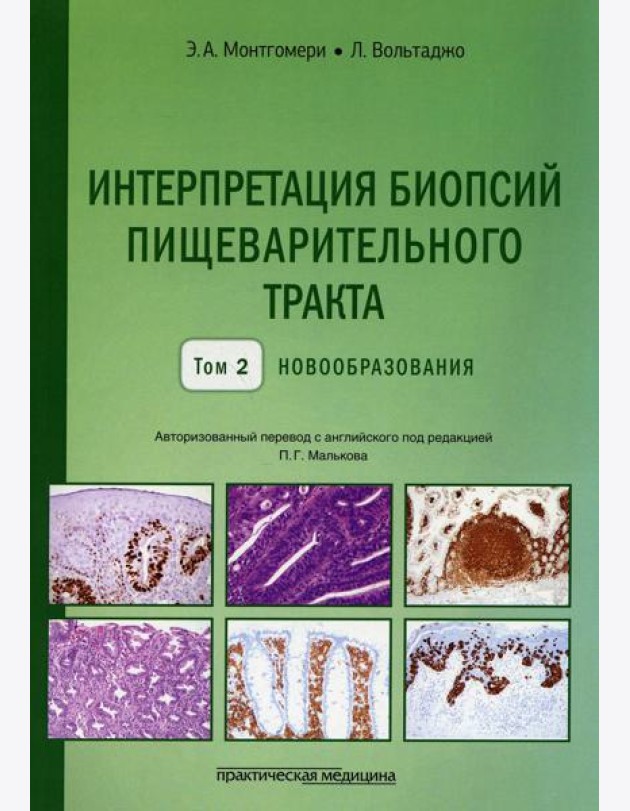 Интерпретация биопсий пищеварительного тракта. Т. 2: Новообразования