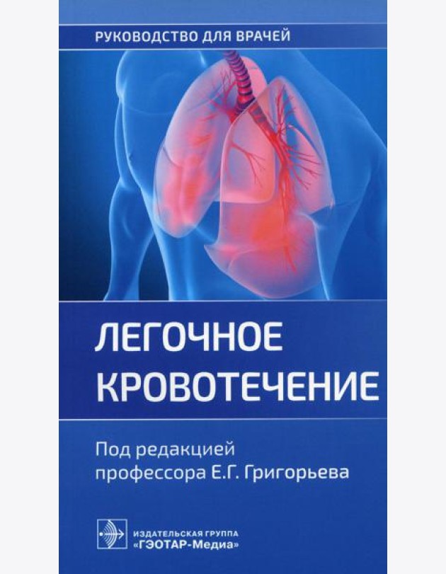 Легочное кровотечение. Руководство для врачей