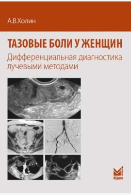 Тазовые боли у женщин. Дифференцианальная диагностика лучевыми методами