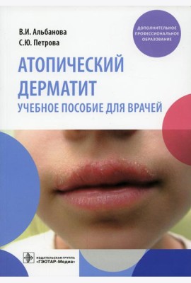 Атопический дерматит: Учебное пособие для врачей