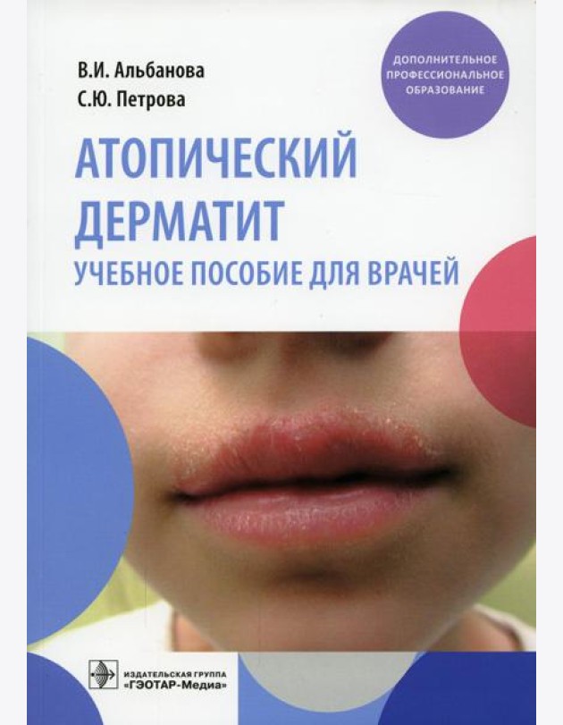 Атопический дерматит: Учебное пособие для врачей