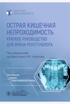 Острая кишечная непроходимость. Краткое руководство для врача-рентгенолога