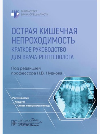 Острая кишечная непроходимость. Краткое руководство для врача-рентгенолога