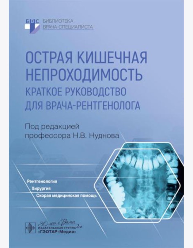 Острая кишечная непроходимость. Краткое руководство для врача-рентгенолога