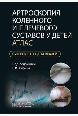 Артроскопия коленного и плечевого суставов у детей. Атлас : руководство для врачей