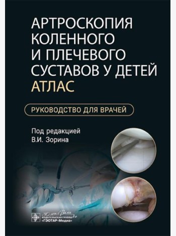 Артроскопия коленного и плечевого суставов у детей. Атлас : руководство для врачей