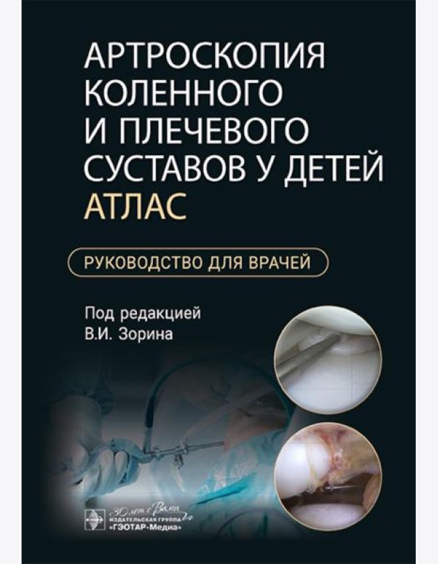 Артроскопия коленного и плечевого суставов у детей. Атлас : руководство для врачей