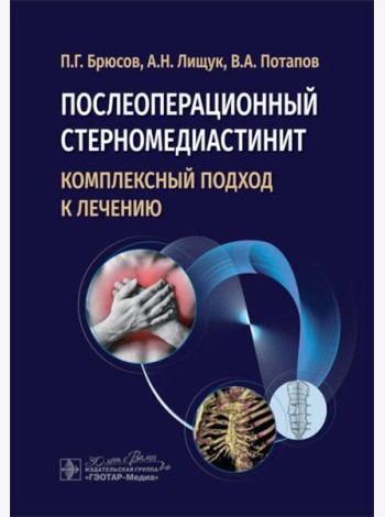 Послеоперационный стерномедиастинит. Комплексный подход к лечению