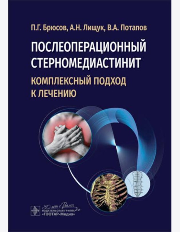 Послеоперационный стерномедиастинит. Комплексный подход к лечению