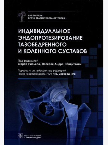Индивидуальное эндопротезирование тазобедренного и коленного суставов