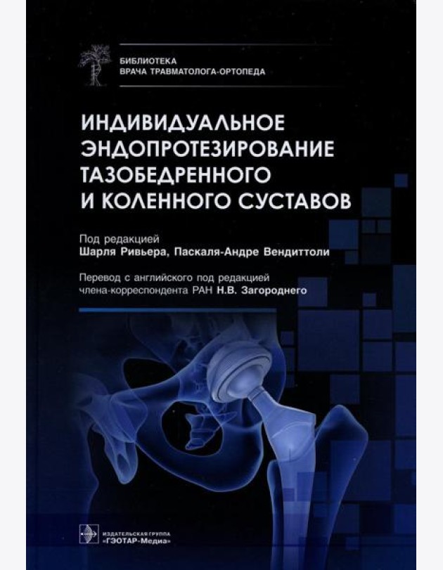 Индивидуальное эндопротезирование тазобедренного и коленного суставов
