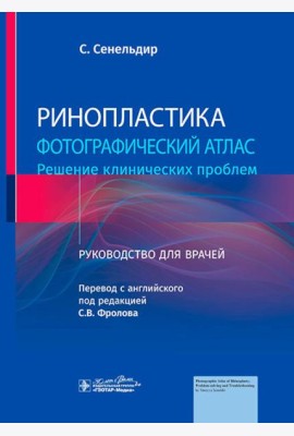 Ринопластика. Фотографический атлас. Решение клинических проблем: руководство для врачей