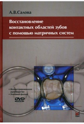 Восстановление контактных областей зубов с помощью матричных систем. 2-е изд., + CD