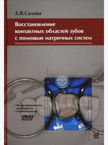 Восстановление контактных областей зубов с помощью матричных систем. 2-е изд., + CD