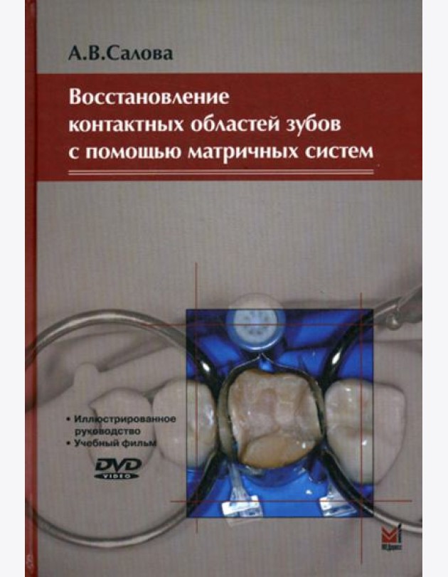 Восстановление контактных областей зубов с помощью матричных систем. 2-е изд., + CD