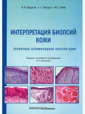 Интерпретация биопсий кожи. Первичные нелимфоидные опухоли кожи