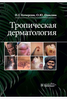 Тропическая дерматология
