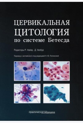 Цервикальная цитология по системе Бетесда. Терминология, критерии и пояснения