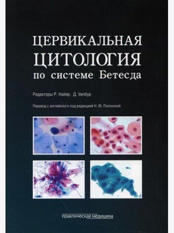 Цервикальная цитология по системе Бетесда. Терминология, критерии и пояснения