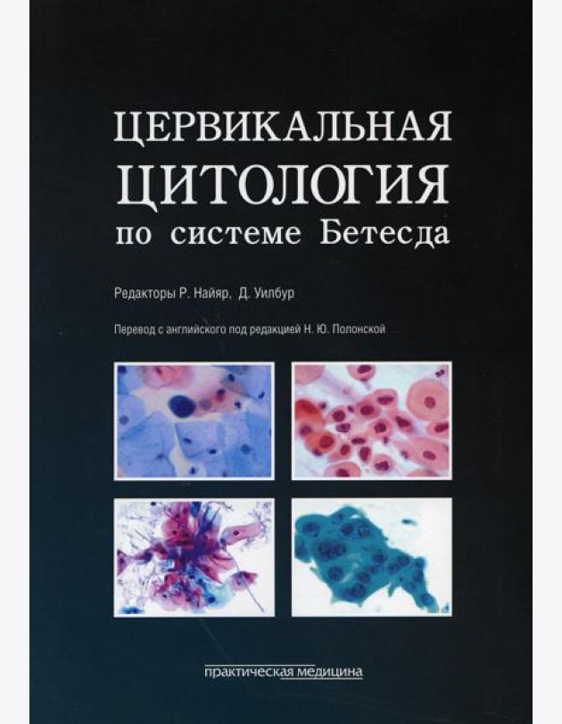 Цервикальная цитология по системе Бетесда. Терминология, критерии и пояснения