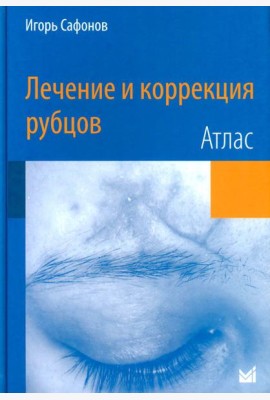 Лечение и коррекция рубцов. Атлас