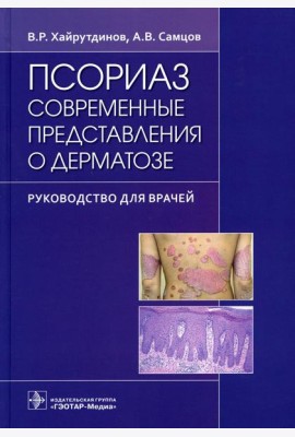 Псориаз. Современные представления о дерматозе: руководство для врачей