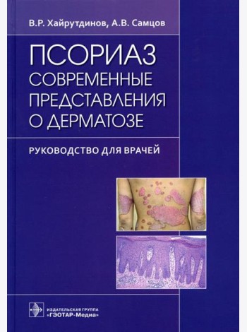 Псориаз. Современные представления о дерматозе: руководство для врачей