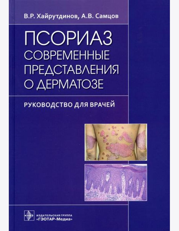 Псориаз. Современные представления о дерматозе: руководство для врачей