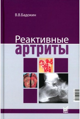 Реактивные артриты. Урогенитальные и постэнтероколитические. 2-е изд