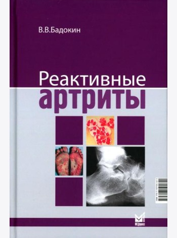 Реактивные артриты. Урогенитальные и постэнтероколитические. 2-е изд