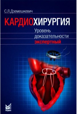 Кардиохирургия. Уровень доказательности экспертный