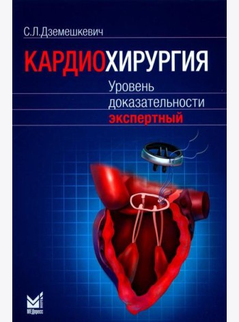 Кардиохирургия. Уровень доказательности экспертный