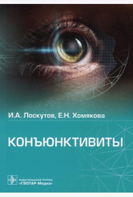 Конъюнктивиты