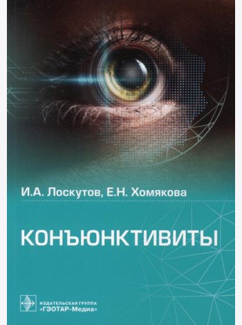 Конъюнктивиты