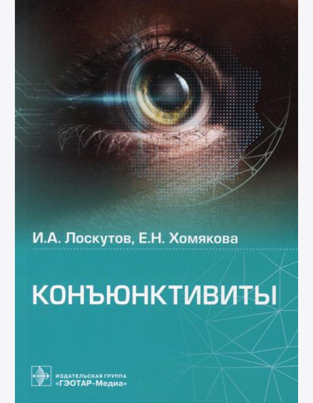 Конъюнктивиты